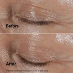 کرم دور چشم کلینیک مدل Smart Clinical Repair حجم 15ml