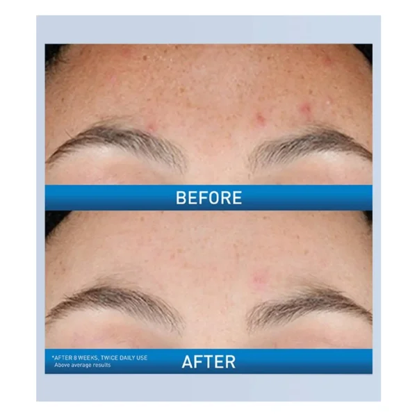 سرم پوست سراوی مدل Resurfacing Retinol حجم 30m